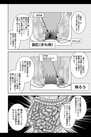 痔ろう闘病記マンガ版