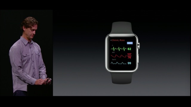 Apple Watchの医療アプリ「AirStrip」は病院に行く手間を減らすかも