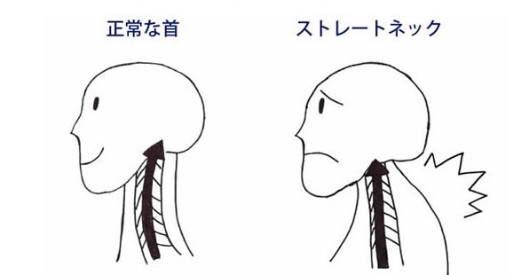 STRAIGHTNEC - 1 (2)