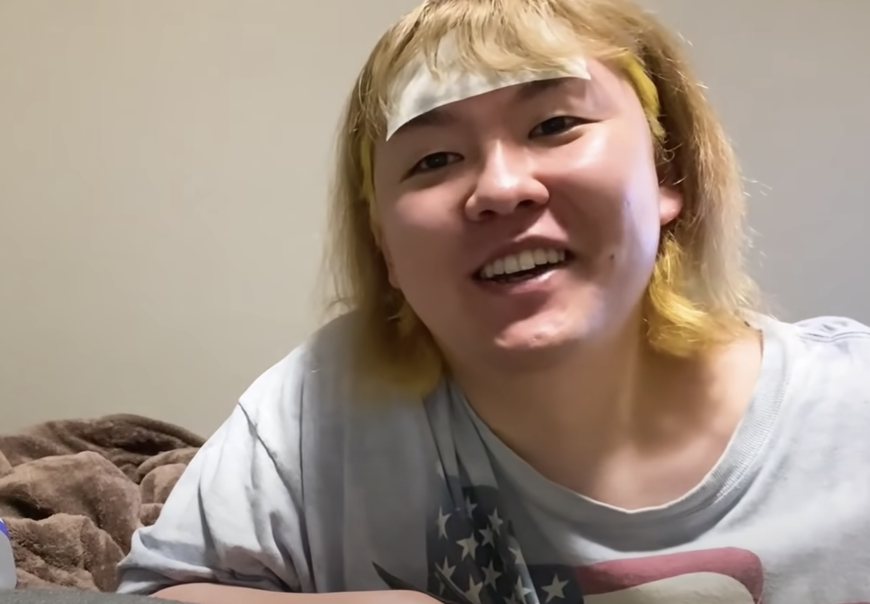 原宿の母ぺえが慢性扁桃炎と診断される 体調不良が続く彼にファンの反応は Appbank