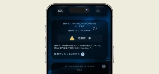 睡眠時無呼吸症候群(SAS)アラート機能のアプリ画面