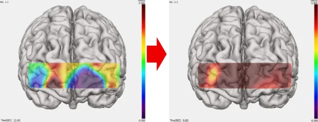 ブロックスプレイ中の脳血液量変化を示す脳波画像