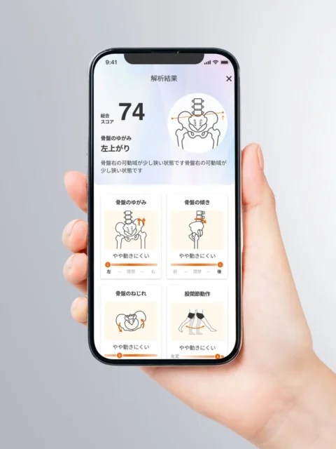 「my Symmetry」アプリの姿勢解析結果画面、骨盤のゆがみや関節動作を表示